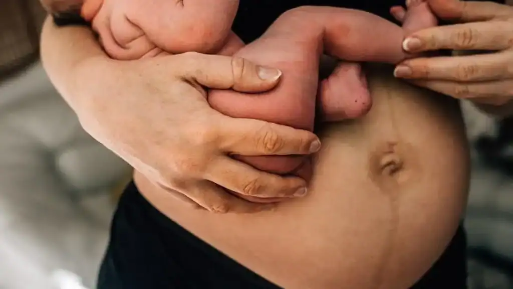 Why Is My Stomach Still Big After Pregnancy Aldridge?